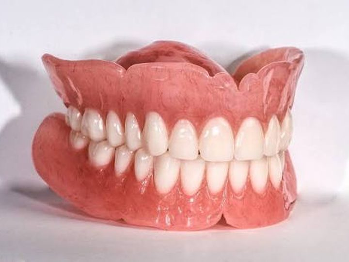 دست دندان کامل — نمونه ۲